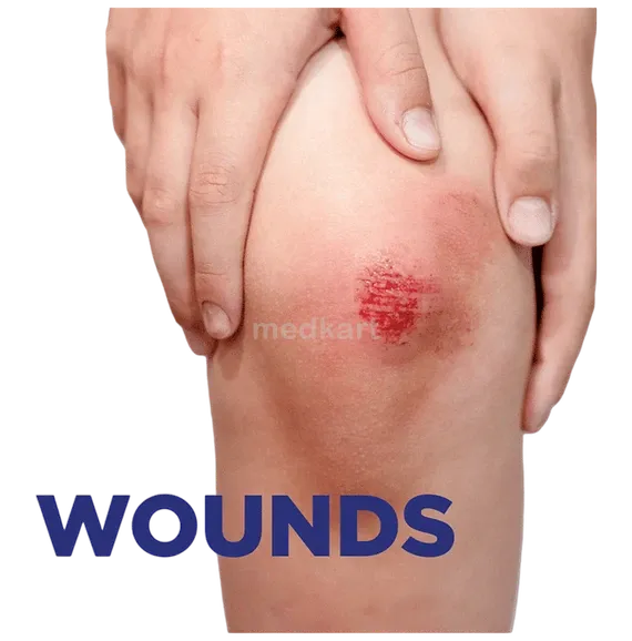 soframycin skin cream 30 gm